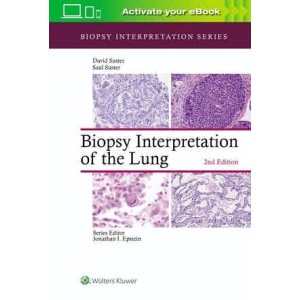 παθολογοανατομια - Biopsy Interpretation of the Lung Παθολογοανατομία