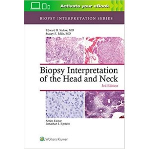 παθολογοανατομια - Biopsy Interpretation of the Head and Neck ,Biopsy Interpretation Series Παθολογοανατομία
