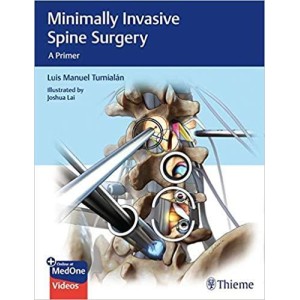 Minimally Invasive Spine Surgery A Primer Ορθοπεδική
