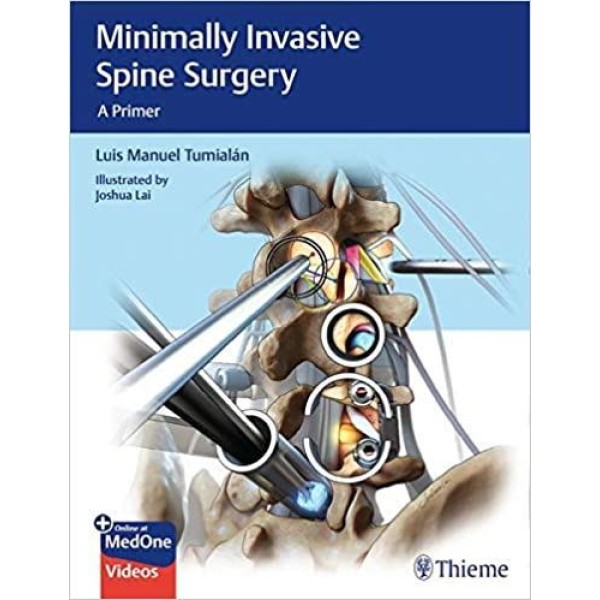 Minimally Invasive Spine Surgery A Primer Ορθοπεδική