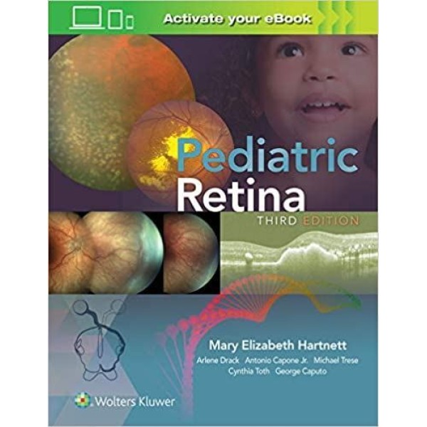 Pediatric Retina Οφθαλμολογία