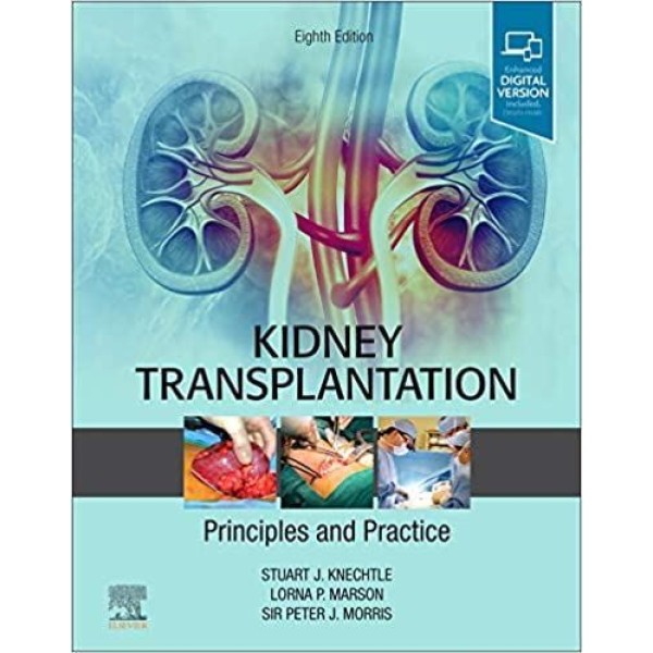 Kidney Transplantation - Principles and Practice Χειρουργική
