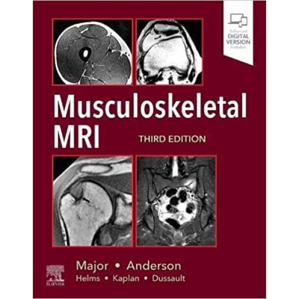 Musculoskeletal MRI Ακτινολογία