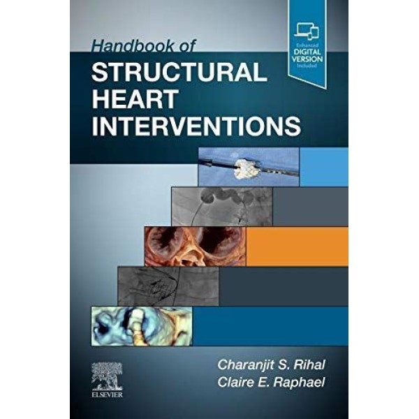 Handbook of Structural Heart Interventions Καρδιολογία
