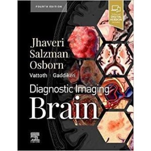 Diagnostic Imaging: Brain Ακτινολογία