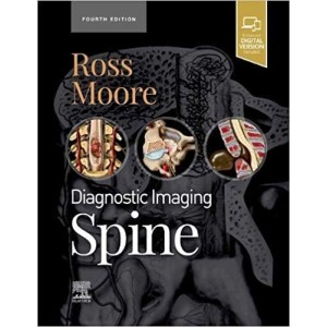 Diagnostic Imaging: Spine Ακτινολογία