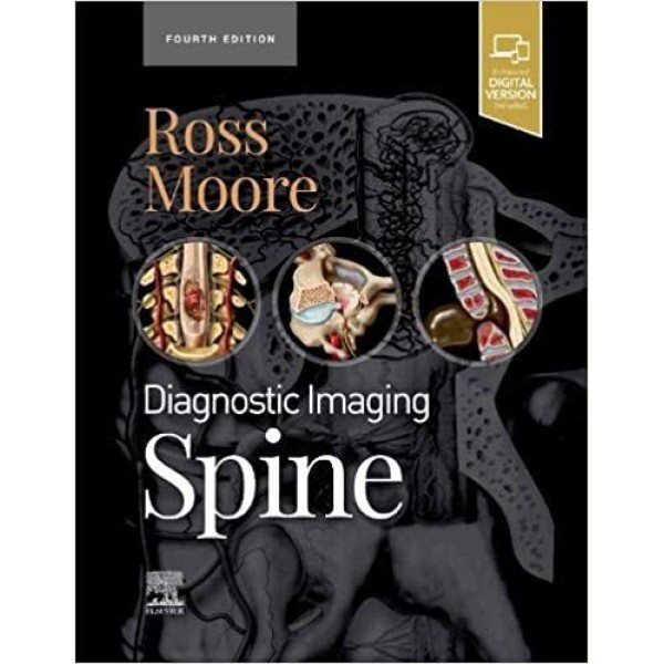 Diagnostic Imaging: Spine Ακτινολογία