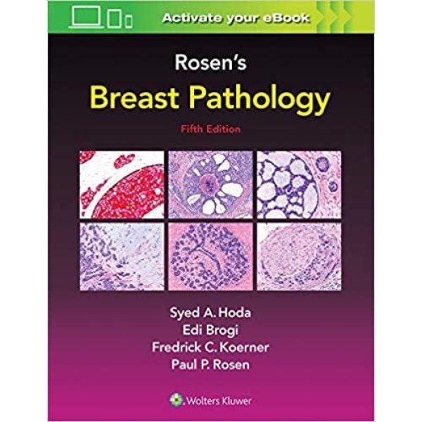 παθολογοανατομια - Rosen's Breast Pathology Παθολογοανατομία