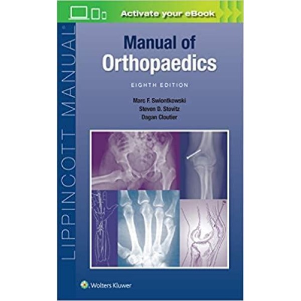 Manual of Orthopaedics Ορθοπεδική