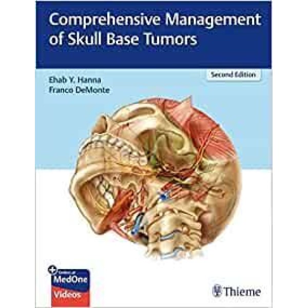 Comprehensive Management of Skull Base Tumors Ωτορινολαρυγκολογία