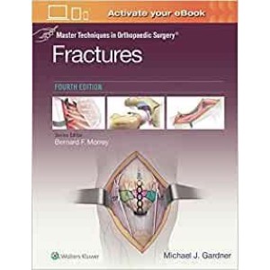 Master Techniques in Orthopaedic Surgery: Fractures Ορθοπεδική