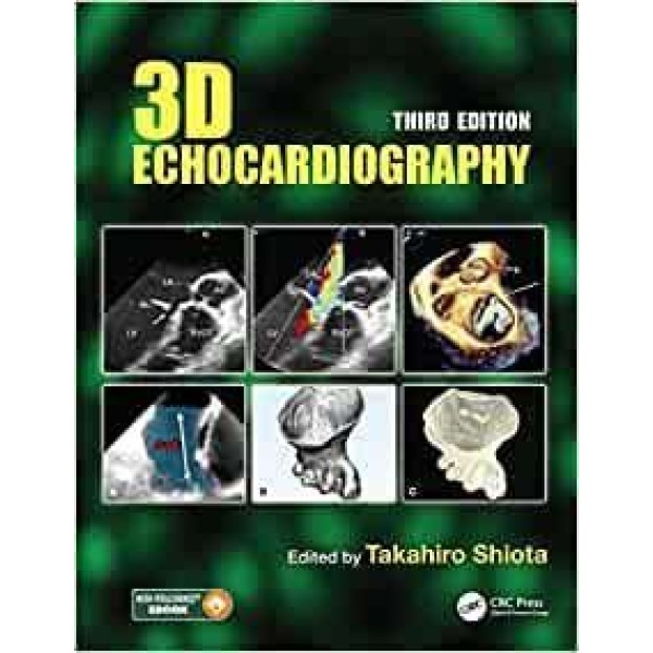 3D Echocardiography Καρδιολογία