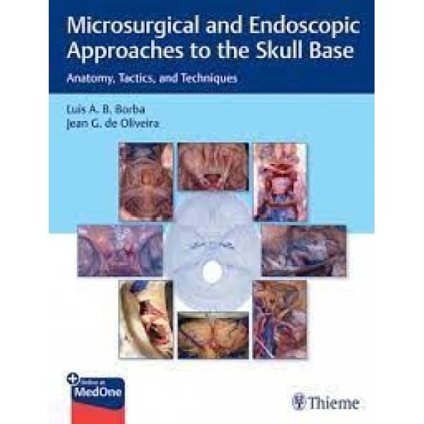 Microsurgical and Endoscopic Approaches to the Skull Base Anatomy, Tactics, and Techniques Ωτορινολαρυγκολογία