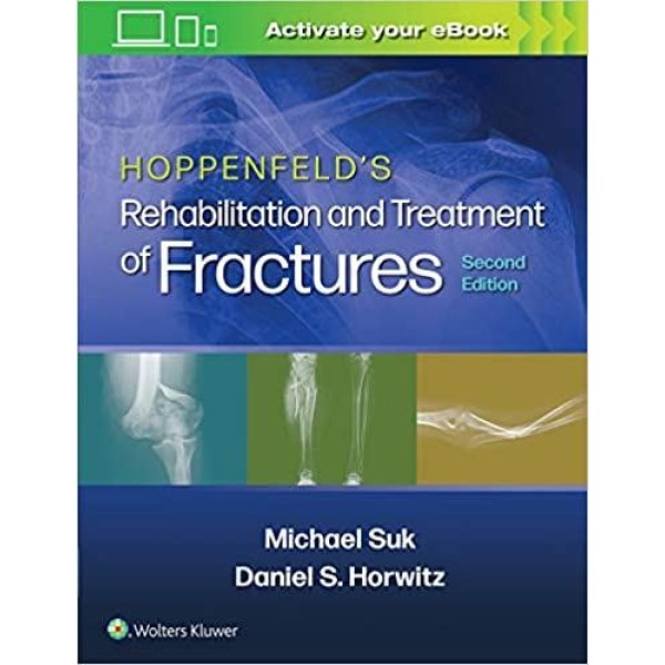Hoppenfeld's Treatment and Rehabilitation of Fractures Ορθοπεδική
