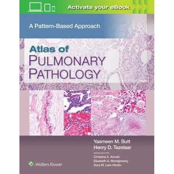 παθολογοανατομια - Atlas of Pulmonary Pathology A Pattern Based Approach Παθολογοανατομία