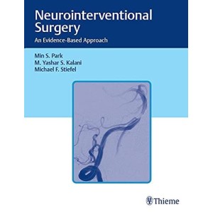 Neurointerventional Surgery An Evidence-Based Approach Νευροχειρουργική