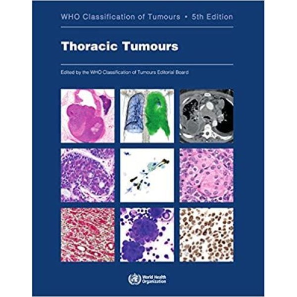 παθολογοανατομια - WHO Classification of Tumours, Thoracic Tumours Παθολογοανατομία