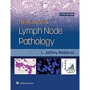 παθολογοανατομια - Ioachim's Lymph Node Pathology Παθολογοανατομία