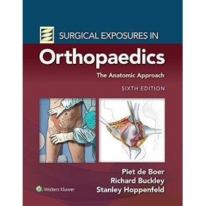 Surgical Exposures in Orthopaedics: The Anatomic Approach Ορθοπεδική