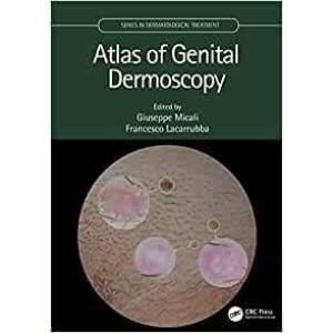 Atlas of Genital Dermoscopy Δερματολογία
