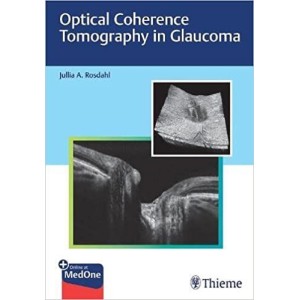 Optical Coherence Tomography in Glaucoma Οφθαλμολογία