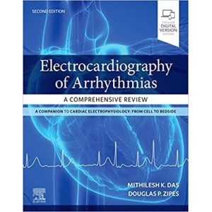 Electrocardiography of Arrhythmias: A Comprehensive Review Καρδιολογία