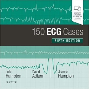 150 ECG Cases Καρδιολογία