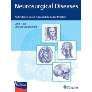 Neurosurgical Diseases An Evidence-Based Approach to Guide Practice Νευροχειρουργική