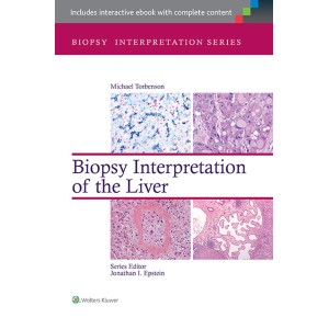παθολογοανατομια - Biopsy Interpretation of the Liver Παθολογοανατομία