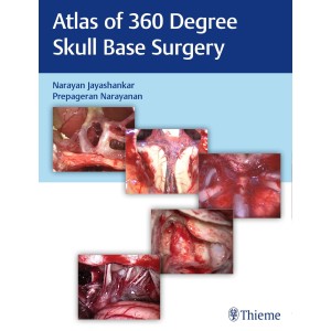 Atlas of 360 Degree Skull Base Surgery Ωτορινολαρυγκολογία
