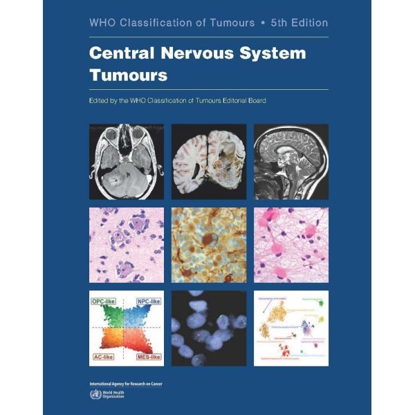παθολογοανατομια - WHO Central Nervous System Tumours Παθολογοανατομία