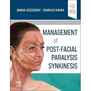Management of Post-Facial Paralysis Synkinesis Πλαστική Χειρουργική