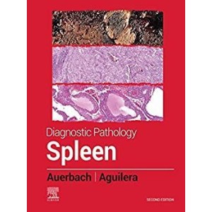 παθολογοανατομια - Diagnostic Pathology: Spleen Παθολογοανατομία