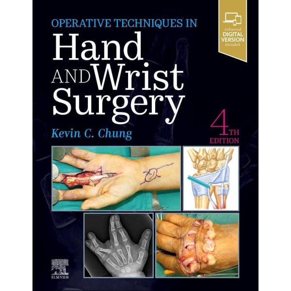 Operative Techniques: Hand and Wrist Surgery Ορθοπεδική
