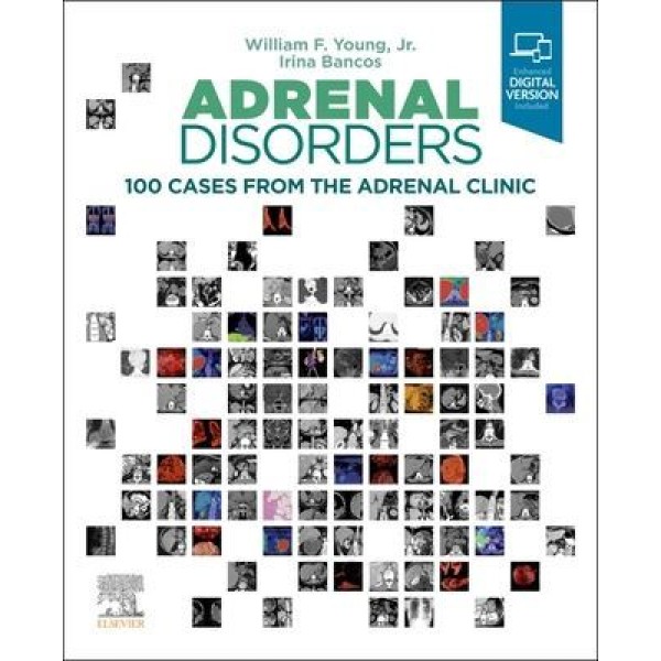 Adrenal Disorders 100 Cases from the Adrenal Clinic Ενδοκρινολογία