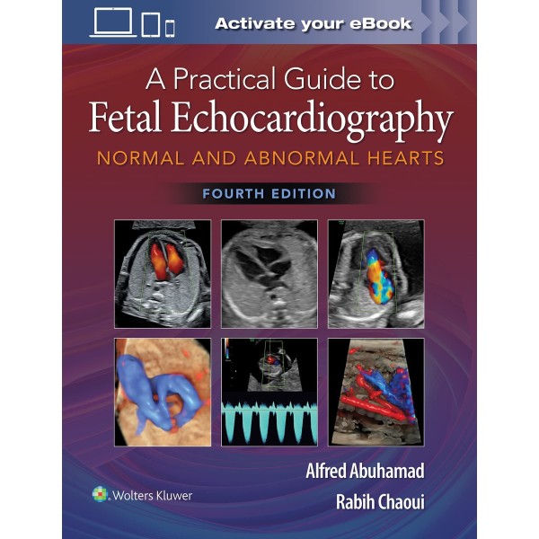 A Practical Guide to Fetal Echocardiography Normal and Abnormal Hearts Καρδιολογία