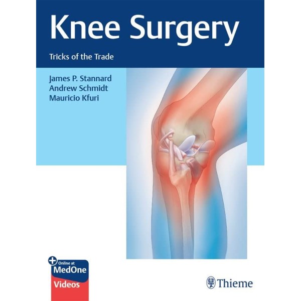 Knee Surgery Tricks of the Trade Ορθοπεδική