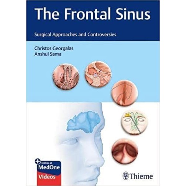 The Frontal Sinus Surgical Approaches and Controversies Ωτορινολαρυγκολογία