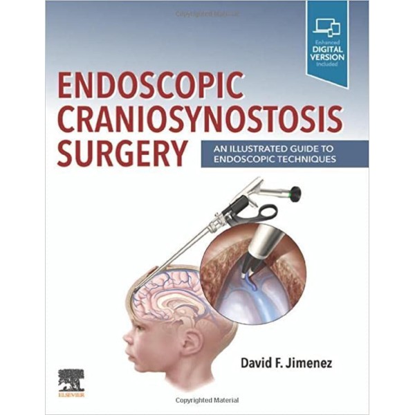 Endoscopic Craniosynostosis Surgery, 1st Edition An Illustrated Guide to Endoscopic Techniques Νευροχειρουργική