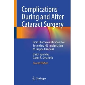 Complications During and After Cataract Surgery From Phacoemulsification Over Secondary IOL Implantation to Dropped Nucleus Οφθαλμολογία