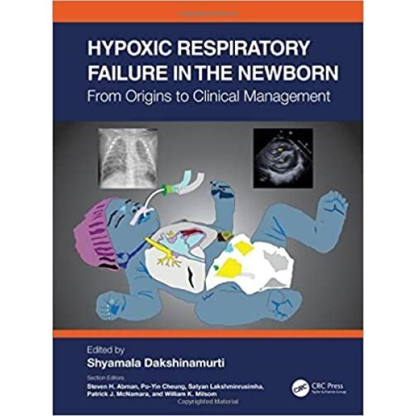 παιδιατρικη - Hypoxic Respiratory Failure in the Newborn From Origins to Clinical Management Παιδιατρική
