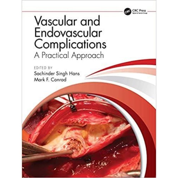 Vascular and Endovascular Complications: A Practical Approach Αγγειοχειρουργική