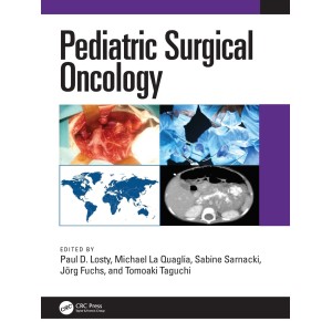 Pediatric Surgical Oncology Παιδοχειρουργική