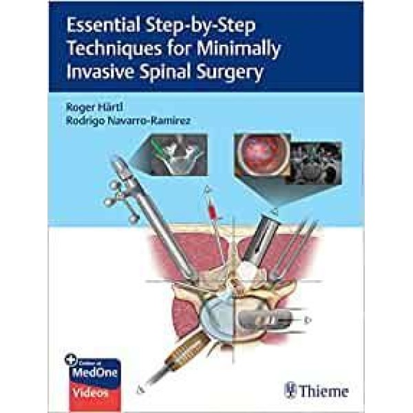 Essential Step-by-Step Techniques for Minimally Invasive Spinal Surgery Ορθοπεδική