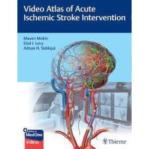 Video Atlas of Acute Ischemic Stroke Intervention Νευροχειρουργική