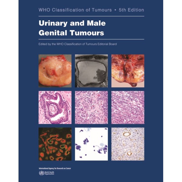 παθολογοανατομια - Urinary and Male Genital Tumours WHO Classification of Tumours, 5th Edition, Volume 8 Παθολογοανατομία