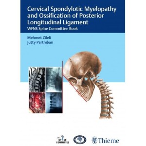 Cervical Spondylotic Myelopathy and Ossification of Posterior Longitudinal Ligament WFNS Spine Committee Book Νευροχειρουργική