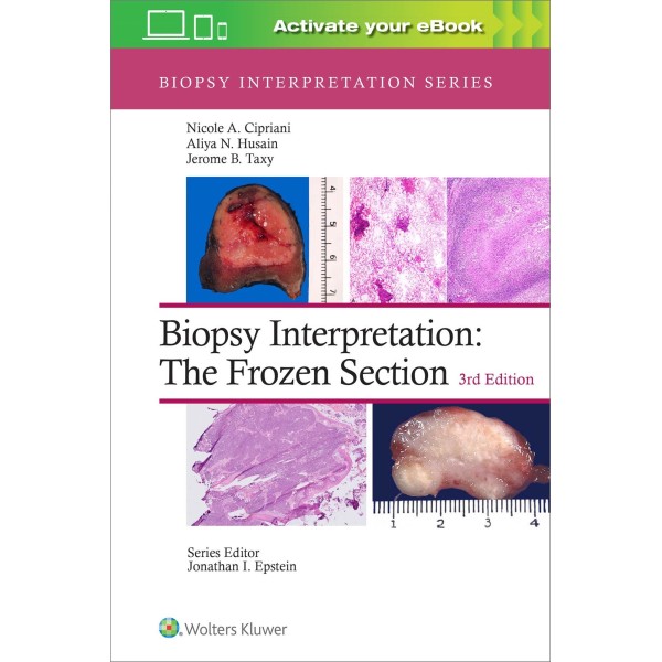 παθολογοανατομια - Biopsy Interpretation: The Frozen Section Παθολογοανατομία