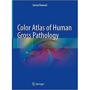 παθολογοανατομια - Color Atlas of Human Gross Pathology Παθολογοανατομία