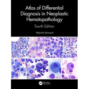 παθολογοανατομια - Atlas of Differential Diagnosis in Neoplastic Hematopathology Παθολογοανατομία